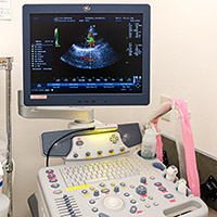 エコー診断装置