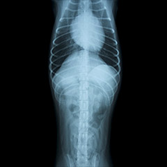 単純レントゲン写真