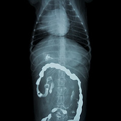 バリウム造影のレントゲン写真