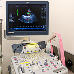 超音波診断装置